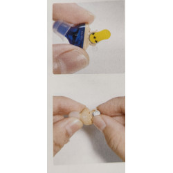 AUXILIAR INTRACANAL DE PERILLA