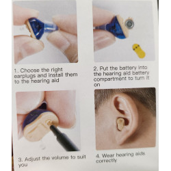 AUXILIAR INTRACANAL DE PERILLA